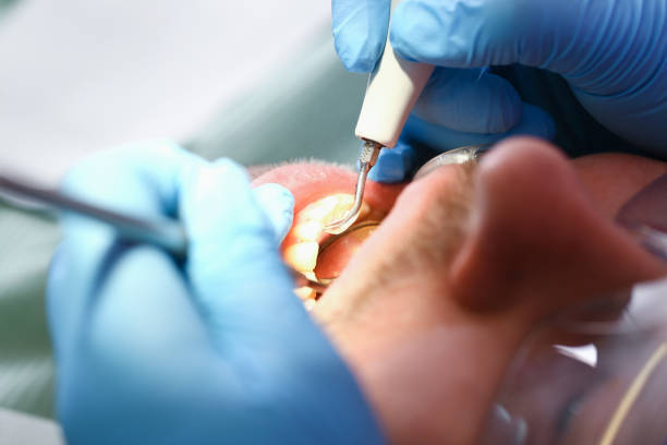 Best Emergency Broken Tooth Repair in Johnstown, PA