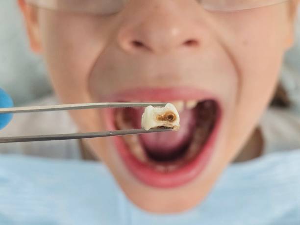 Best Emergency Treatment for Toothache in Johnstown, PA